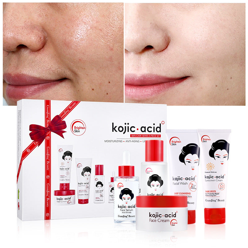 Kojic Acid Toner and Lotion